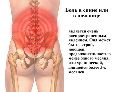Как вылечить боль в спине?